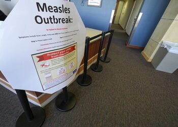 The number of confirmed cases of measles epidemic spread in the United States has increased to 884