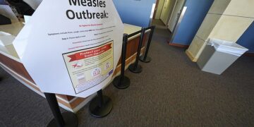 The number of confirmed cases of measles epidemic spread in the United States has increased to 884